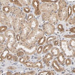 AMPK beta 1 Antibody, Novus Biologicals:Antibodies:Primary Antibodies