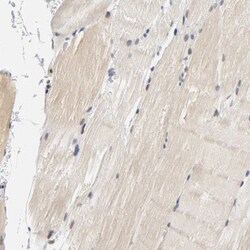 AMPK beta 1 Antibody, Novus Biologicals:Antibodies:Primary Antibodies