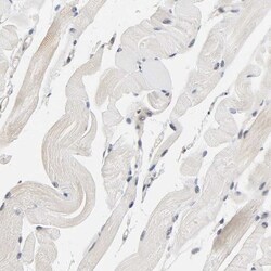 AMPK beta 1 Antibody, Novus Biologicals:Antibodies:Primary Antibodies