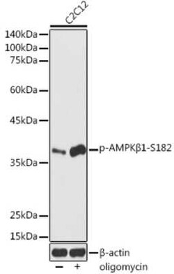 AMPK beta 1 Rabbit anti-Human, Mouse, Rat, Polyclonal, Novus Biologicals
