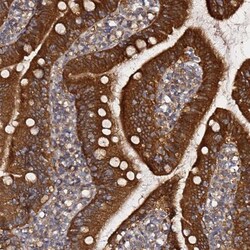 AMPK beta 2/PRKAB2 Antibody, Novus Biologicals 25 &mu;L, Unconjugated:Antibodies,