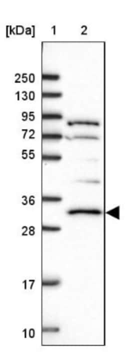 AMPK beta 2/PRKAB2 Antibody, Novus Biologicals 25 &mu;L, Unconjugated:Antibodies,