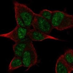 ANGEL2 Rabbit anti-Human, Polyclonal, Novus Biologicals 100 &mu;g; Unconjugated:Antibodies,
