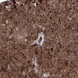 ANKAR Antibody, Novus Biologicals 0.1mL; Unlabeled:Antibodies, Polyclonal