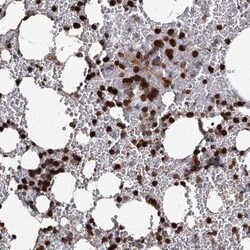 ANKDD1A Antibody, Novus Biologicals:Antibodies:Primary Antibodies