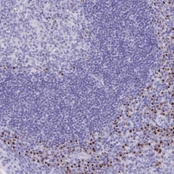 ANKDD1B Antibody, Novus Biologicals 0.1mL; Unlabeled:Antibodies, Polyclonal