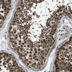 ANKIB1 Antibody, Novus Biologicals 25 &mu;L; Unlabeled:Antibodies, Polyclonal