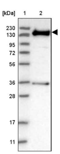 ANKIB1 Antibody, Novus Biologicals:Antibodies:Primary Antibodies