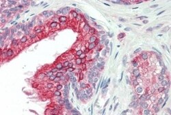 ANKK1 Antibody, Novus Biologicals 0.1 mg | Buy Online | Novus Biologicals | Fisher Scientific