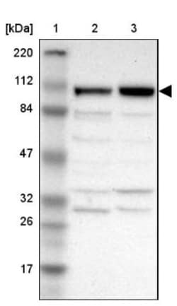ANKLE2 Antibody, Novus Biologicals 25 &mu;L; Unlabeled:Antibodies, Polyclonal