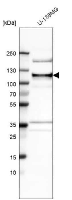 ANKLE2 Antibody, Novus Biologicals 25 &mu;L; Unlabeled:Antibodies, Polyclonal