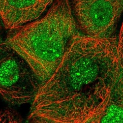ANKMY1 Antibody, Novus Biologicals 0.1mL; Unlabeled:Antibodies, Polyclonal