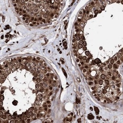 ANKRD12 Antibody, Novus Biologicals 0.1mL; Unlabeled:Antibodies, Polyclonal