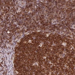 ANKRD13A Antibody, Novus Biologicals:Antibodies:Primary Antibodies