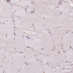 ANKRD13A Antibody, Novus Biologicals:Antibodies:Primary Antibodies