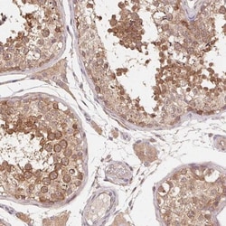 ANKRD13A Antibody, Novus Biologicals:Antibodies:Primary Antibodies