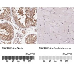 ANKRD13A Antibody, Novus Biologicals:Antibodies:Primary Antibodies