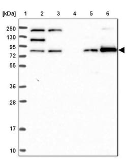 ANKRD13A Antibody, Novus Biologicals:Antibodies:Primary Antibodies