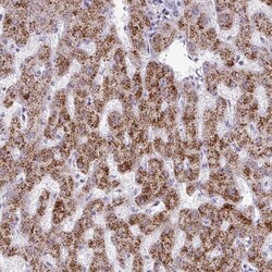 ANKRD13B Antibody, Novus Biologicals:Antibodies:Primary Antibodies