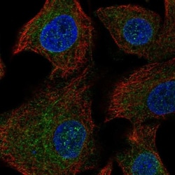 ANKRD16 Antibody, Novus Biologicals 0.1mL; Unlabeled:Antibodies, Polyclonal