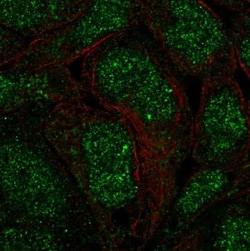 ANKRD22 Antibody, Novus Biologicals 25 &mu;L; Unlabeled:Antibodies, Polyclonal