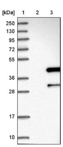 ANKRD23 Antibody, Novus Biologicals:Antibodies:Primary Antibodies