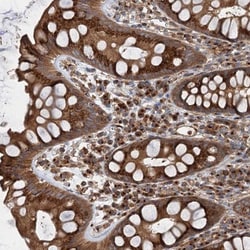 ANKRD26 Antibody, Novus Biologicals 0.1mL; Unlabeled:Antibodies, Polyclonal