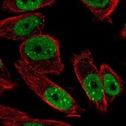ANKRD29 Antibody, Novus Biologicals 0.1mL; Unlabeled:Antibodies, Polyclonal