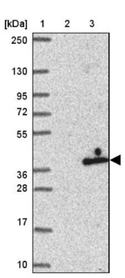 ANKRD29 Antibody, Novus Biologicals 0.1mL; Unlabeled:Antibodies, Polyclonal