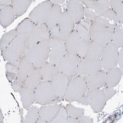 ANKRD35 Antibody, Novus Biologicals 25 μL, Unlabeled:Antibodies, Polyclonal