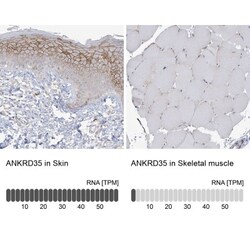 ANKRD35 Antibody, Novus Biologicals 25 μL, Unlabeled:Antibodies, Polyclonal