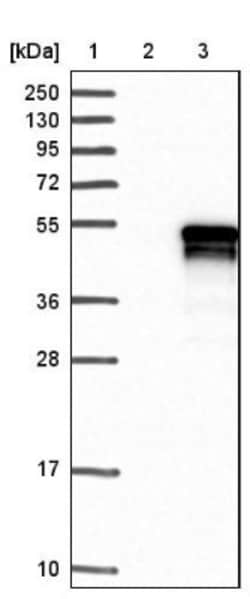 ANKRD40 Antibody, Novus Biologicals 0.1mL; Unlabeled:Antibodies, Polyclonal