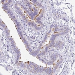 ANKRD45 Antibody, Novus Biologicals 0.1mL; Unlabeled:Antibodies, Polyclonal
