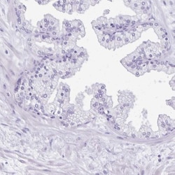 ANKRD45 Antibody, Novus Biologicals 0.1mL; Unlabeled:Antibodies, Polyclonal
