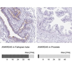 ANKRD45 Antibody, Novus Biologicals 0.1mL; Unlabeled:Antibodies, Polyclonal