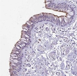 ANKRD45 Antibody, Novus Biologicals:Antibodies:Primary Antibodies