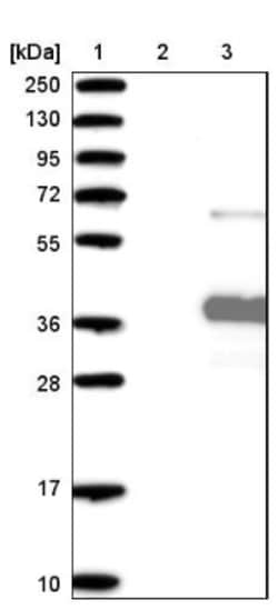 ANKRD45 Antibody, Novus Biologicals 0.1mL; Unlabeled:Antibodies, Polyclonal