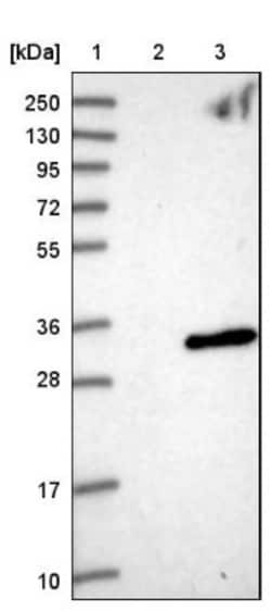 ANKRD46 Antibody, Novus Biologicals 0.1mL; Unlabeled:Antibodies, Polyclonal