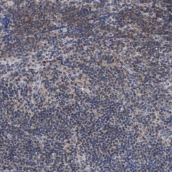 ANKRD55 Antibody, Novus Biologicals 0.1mL; Unlabeled:Antibodies, Polyclonal