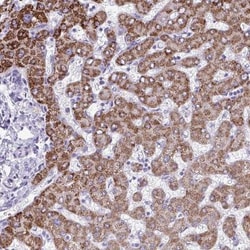 ANKRD60 Antibody, Novus Biologicals 25 &mu;L, Unlabeled:Antibodies, Polyclonal