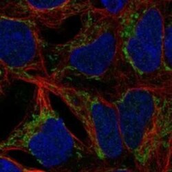 ANKRD63 Rabbit anti-Human, Polyclonal, Novus Biologicals 25 &mu;g | Buy Online | Novus Biologicals | Fisher Scientific