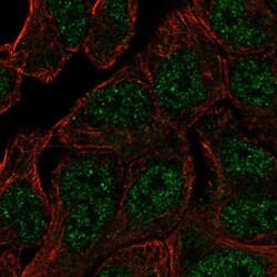 ANKRD65 Antibody, Novus Biologicals 0.1mL; Unlabeled:Antibodies, Polyclonal