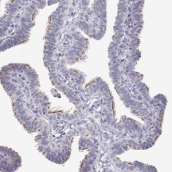 ANKRD65 Antibody, Novus Biologicals 0.1mL; Unlabeled:Antibodies, Polyclonal