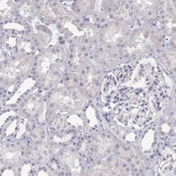 ANKRD65 Antibody, Novus Biologicals 0.1mL; Unlabeled:Antibodies, Polyclonal