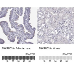 ANKRD65 Antibody, Novus Biologicals 0.1mL; Unlabeled:Antibodies, Polyclonal