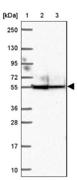 ANKRD65 Antibody, Novus Biologicals 0.1mL; Unlabeled:Antibodies, Polyclonal
