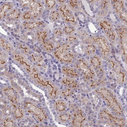 ANKS4B Antibody, Novus Biologicals:Antibodies:Primary Antibodies