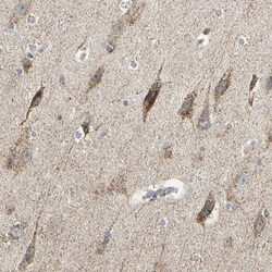 ANKS6 Antibody, Novus Biologicals 25 &mu;L | Buy Online | Novus Biologicals | Fisher Scientific