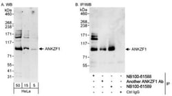 ANKZF1 Antibody, Novus Biologicals 0.1mg; Unlabeled:Antibodies, Polyclonal