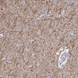 ANO5 Antibody, Novus Biologicals:Antibodies:Primary Antibodies